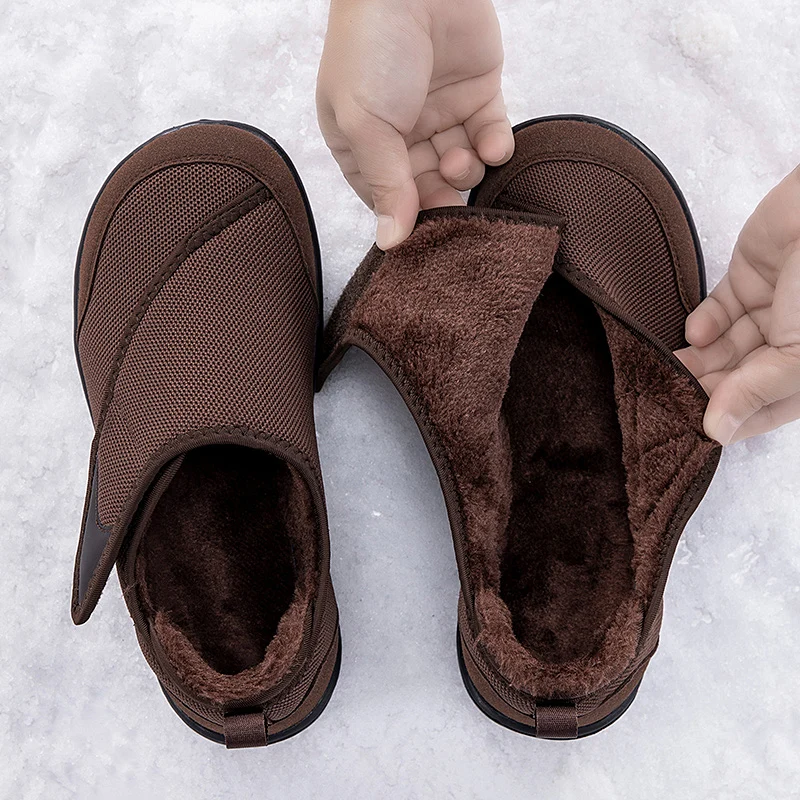 Winter Fur-lined Wide Box Toe Open Shoes for Elderly Men Women Diabetic Shoes Swollen Foot Fat Orthopedics Hallux Valgus Bunion