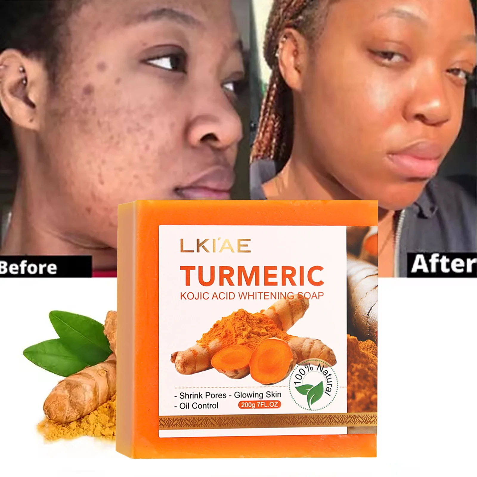 LKIAE Organic Turmeric Soap, Handmade, Whitening, for All Skin Types, Remove Black Spots, Melanin, Acne, For Face, Body, 200g