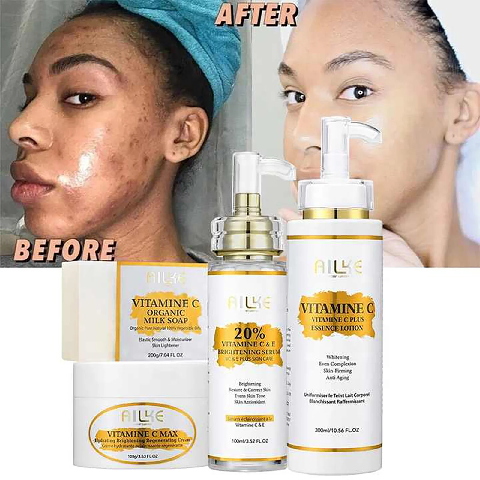 AILKE Vitamin C Set, Reduce Dark Spots, with Lightening Body Lotion, Even Tone Face Cream, Whitening Serum, Brightening Soap