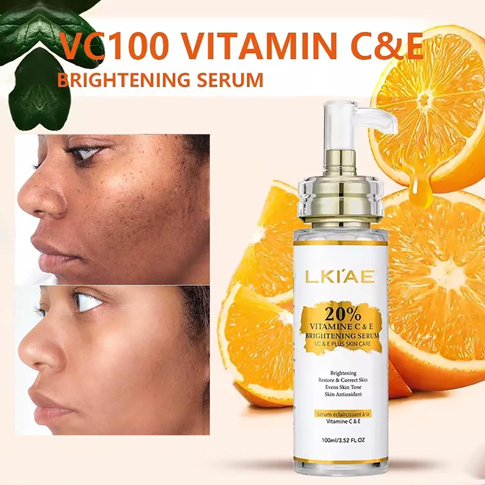 AILKE Vitamin C Set, Reduce Dark Spots, with Lightening Body Lotion, Even Tone Face Cream, Whitening Serum, Brightening Soap