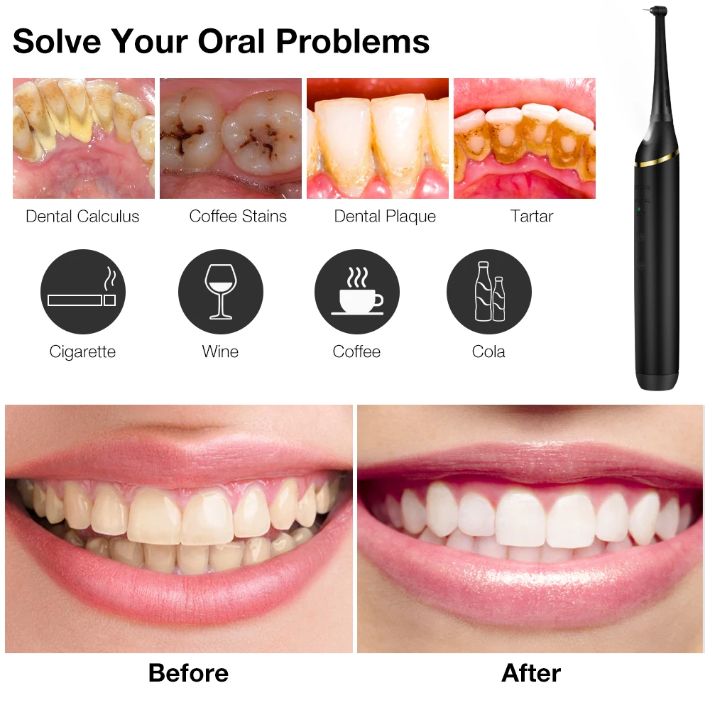 Electric Ultrasonic Dental Scaler 5 Modes Calculus Oral Tartar Remover Tooth Stain 9 Levels Cleaner Teeth Whitening Oral Care