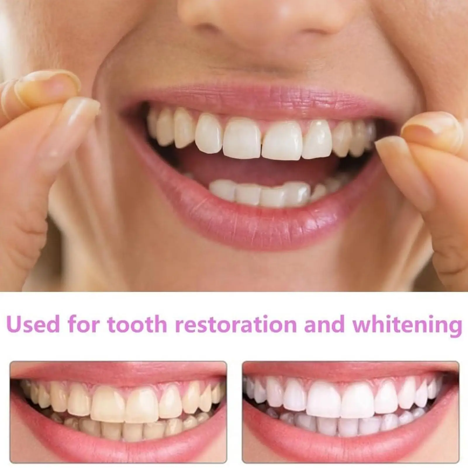 Tooth Veneers Unisex Teeth Veneer Upper Lower Veneers Temporary Smile Improver Instant Confidence Smile Tools Beauty Tool