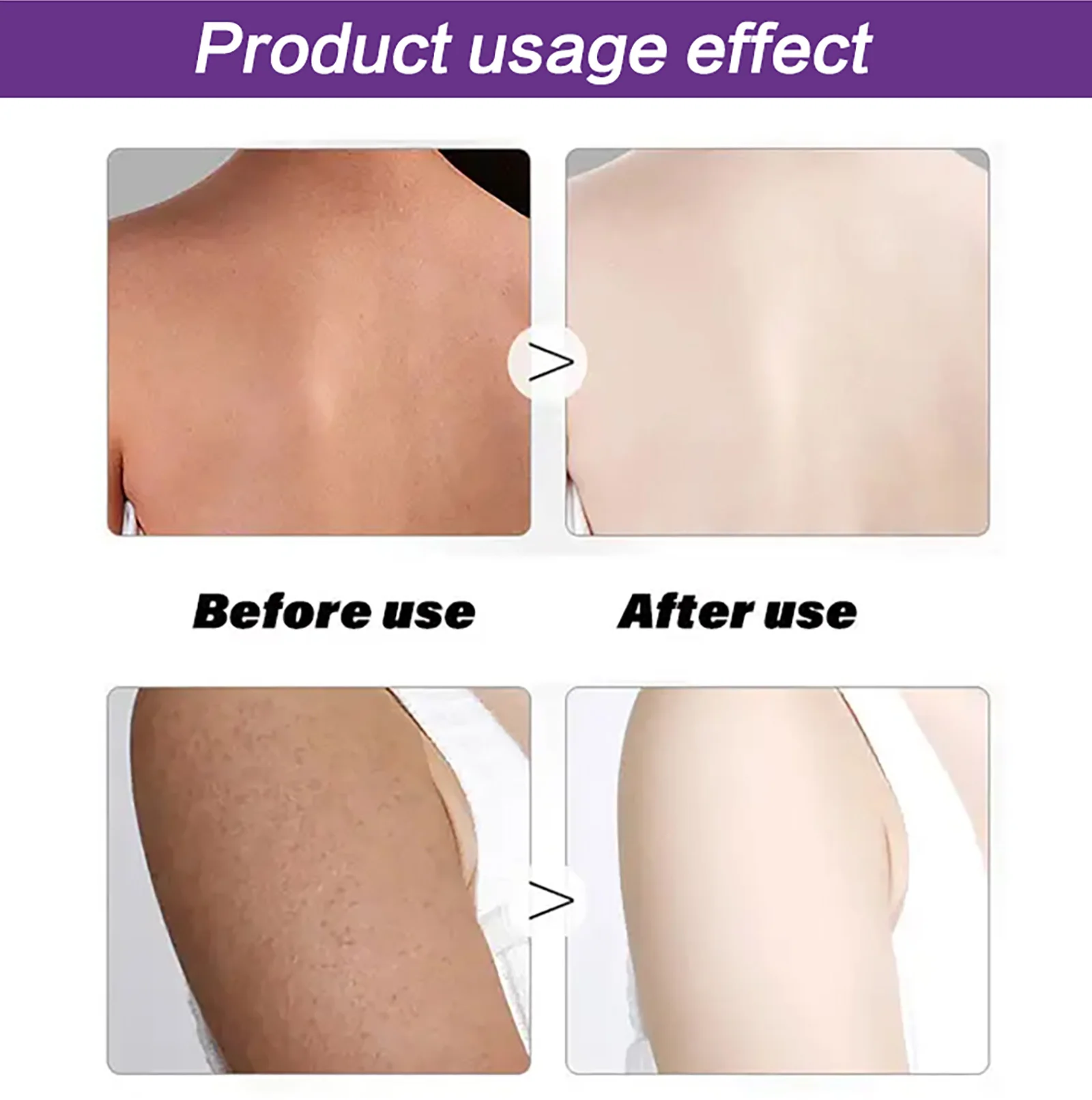 AILKE Dark Spot Corrector PLUS Cream for Women, Uneven Skin Tone, Moisturize, Smooth, Soft, Glowing Skin, 500ml