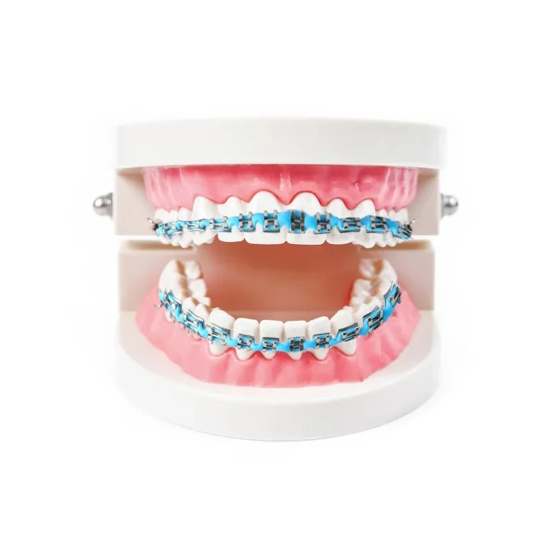 1 Pair Dental Fake Braces Temporary Tooth Decoration Colorful Metal Bracket Ligature Ties Dental Tool With Hook With Metal Wires