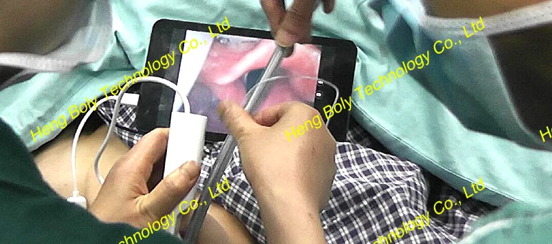 Cheap Video Laryngoscope Digital Portable Disposable USB Video Laryngoscope