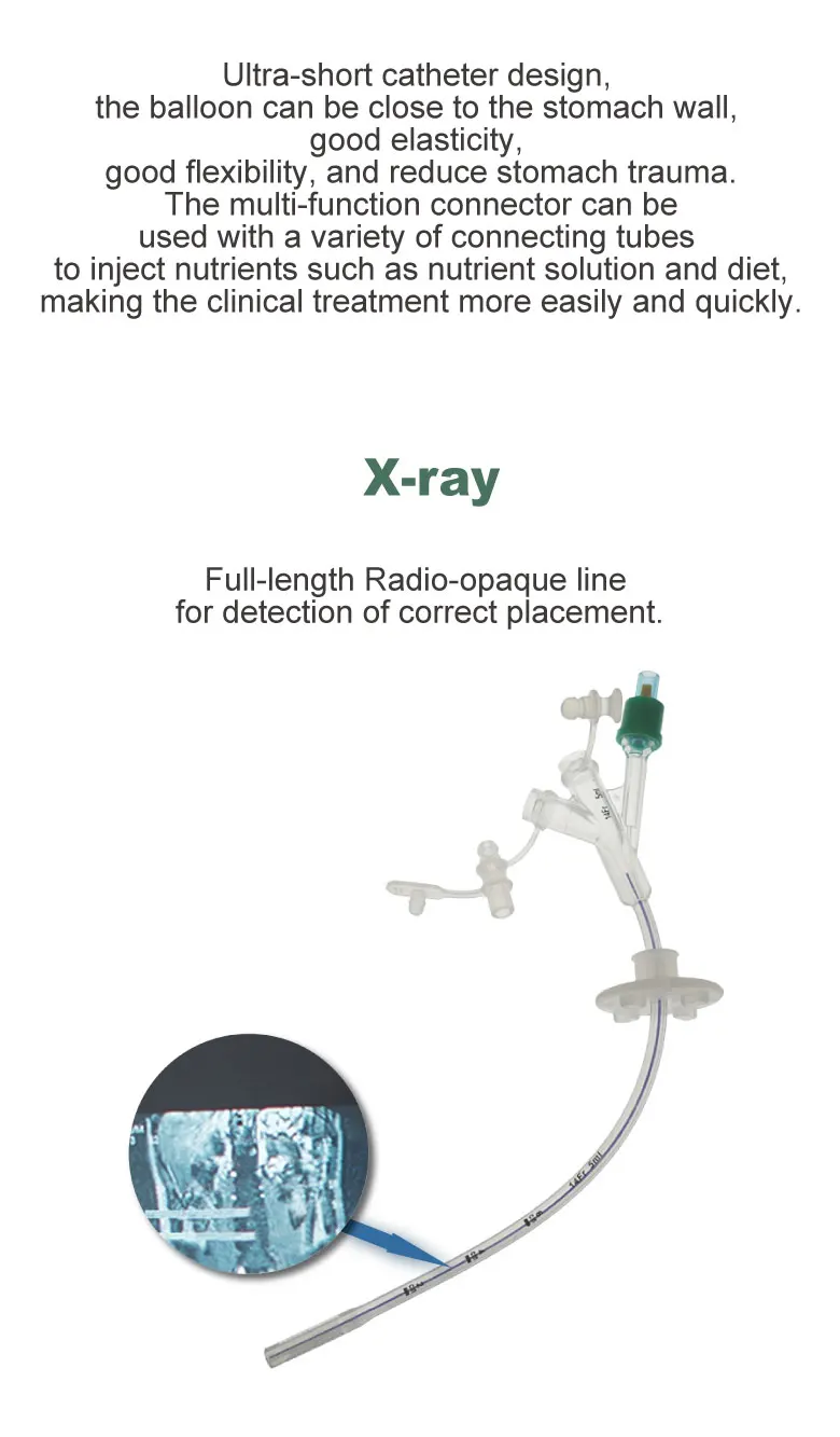 Tierarzt Silicone Gastrostomy Tube Multi Functional Connector X-Ray Imaging Disposable Gastrostomy Surgical Equipment For ICU