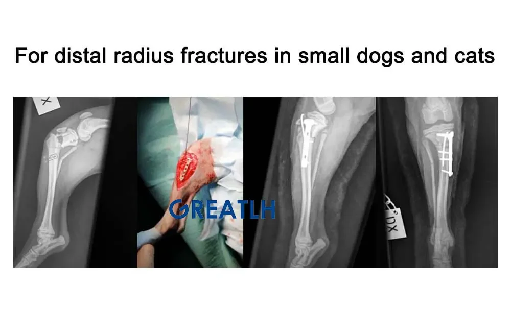 GREATLH Medical Bone Fracture Plate Reconstruction Bone Plate Titanium Small Animal Orthopedic Surgical Instruments