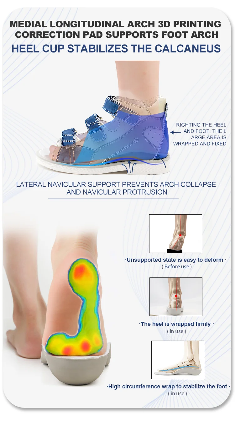 Children Summer Sandals Princepard Kids Girls Boys Orthopedic Shoes High Top Arch Support Varus Valgus Footwear