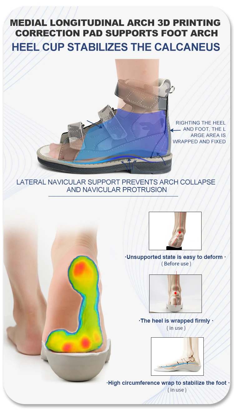 Kids Orthopedic Sandals Princepard Boys Corrective Shoes Children Flatfeet Footwear for Clubfoot Toe Walking Arch Support