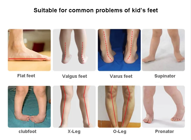 Kids Boys Sneakers Leather Orthopedic Shoes For Children Toddler Adjustable Strap Corrective Sporty Casual School Footwear