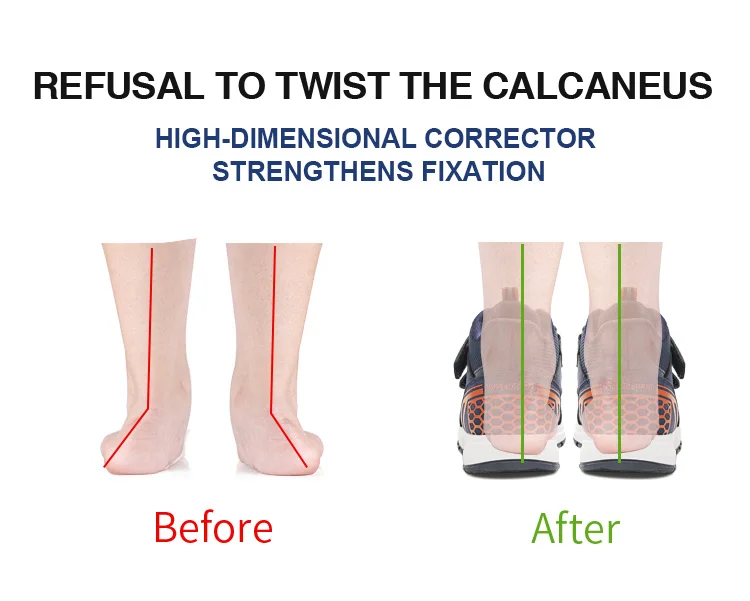 Princepard Kids Orthopedic Sneakers with Ankle Support for Clubfoot and Flatfeet Tennis Footwear Children's Corrective Shoes