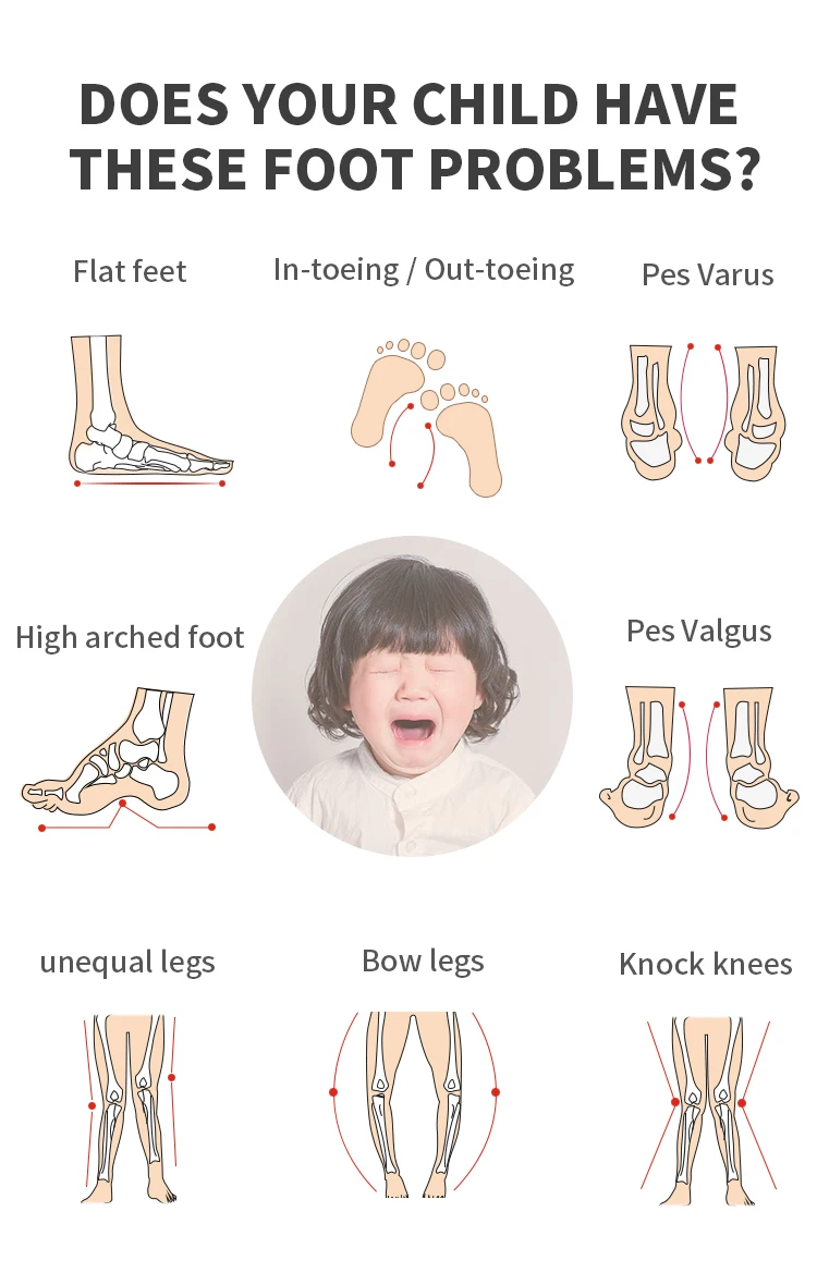 Princepard Children's Orthopedic Sandals Summer Corrective AFO Leather Shoes with Arch Support Thomas Sole EU 20-35