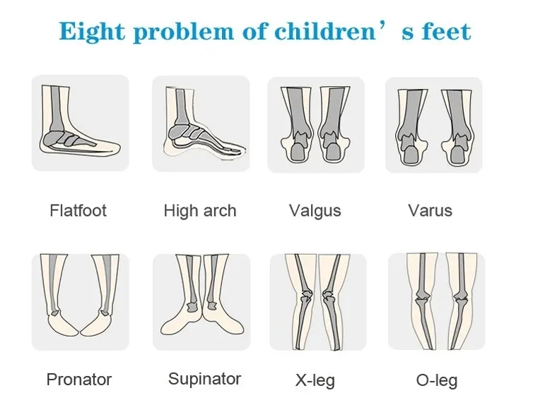 Summer Baby Orthopedic Shoes For Kids Leather High Top Clubfoot Sandals Ankle Support Flat Feet Footwear Size22-34