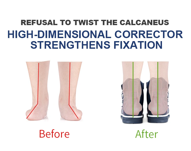 Orthopedic Sandals for Kids and Toddlers, Summer Children's Corrective Shoes for Flat Feet Tiptoe Walking,High-Top Ankle Support