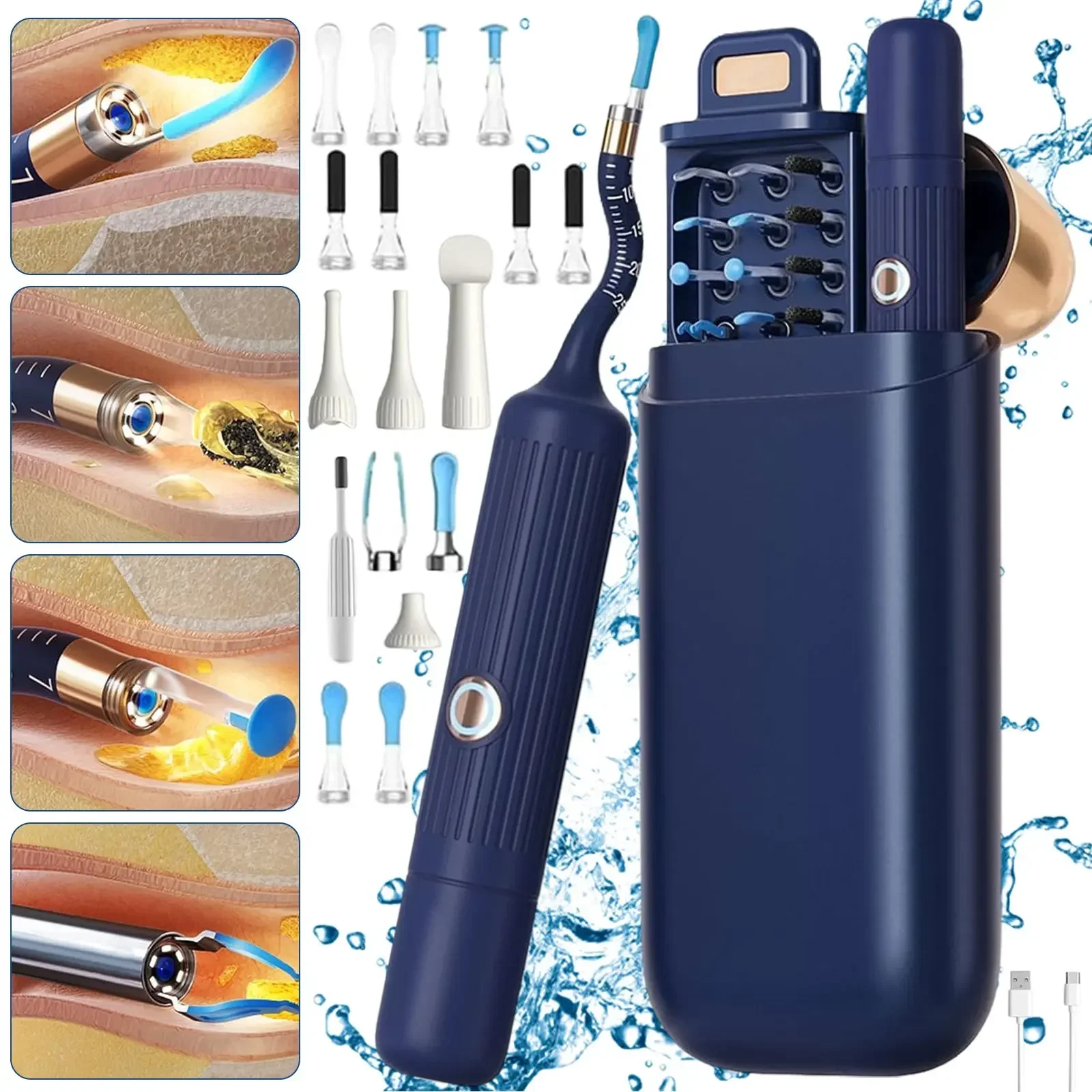 Upgraded ear wax removal kit with camera and light. Wireless flexible otoscope & visual tweezers, painless and portable for ear cleaning.