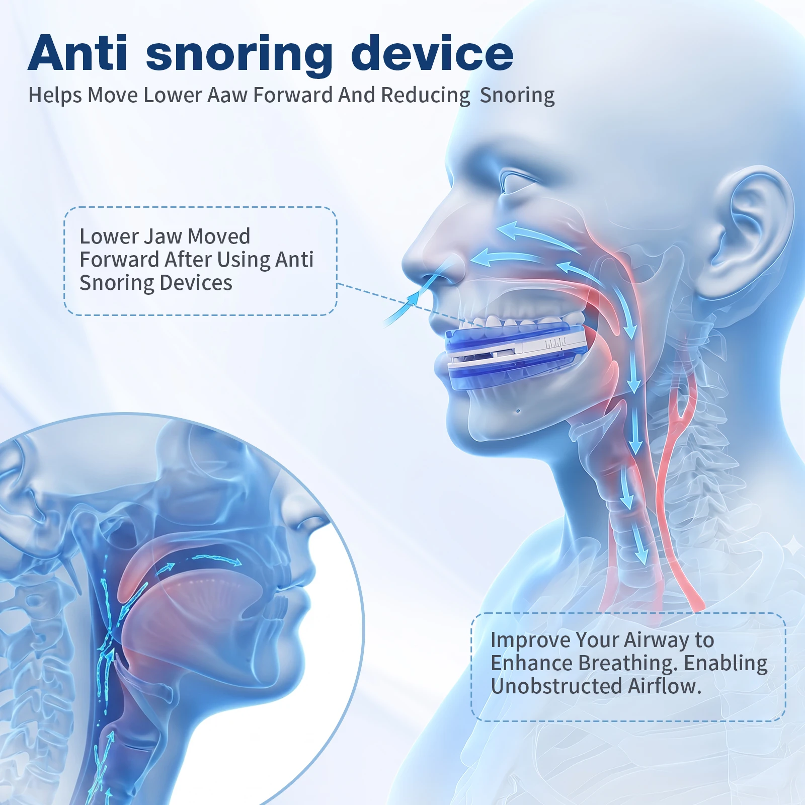 Adjustable Anti Snoring Mouthpiece for Adults, Boil and Bite Custom Fit Sleep Aid, 1mm-6mm Jaw Advancement Oral Device, Open Airflow Design, Reusable Night Guard with Portable Storage Case for Home Travel