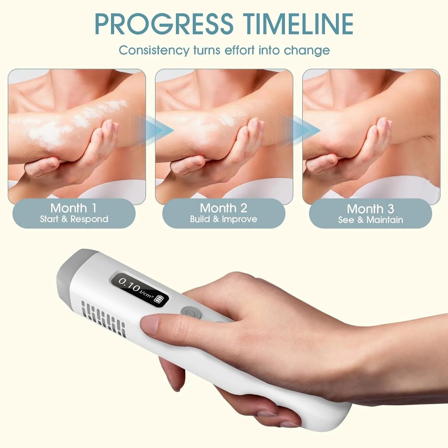 308nm UVB Light Therapy Device Handheld Narrowband Phototherapy Lamp with Adjustable Dose Digital Display 15x15mm Targeted Care Area Rechargeable Portable Home Use for Hands Arms Legs Neck Body Skin Care Includes Protective Glasses