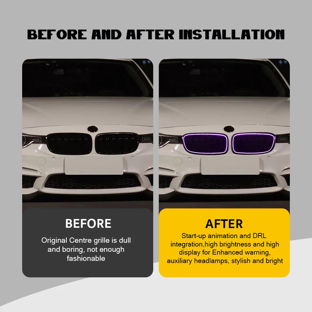 Upgrade Grille For BMW 3 Series F30 2013-2018 2013 2014 2015 2016 2017 2018 Grille Lights RGB Color