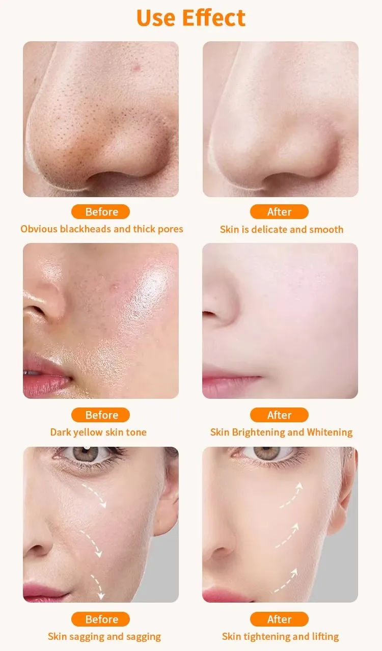 12 In 1 Aqua Peeling Lift Skin Bubble Oxygen Machine Skin Care Cleansing Facial Equipment