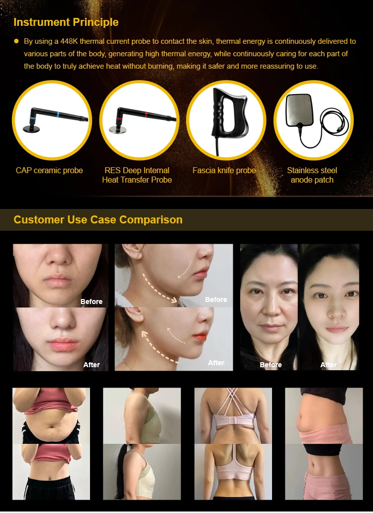 448kHz Multipolar RF Skin Tightening Body Slimming Machine Physio Therapy Machine Body Massager Rehabilitation Equipment