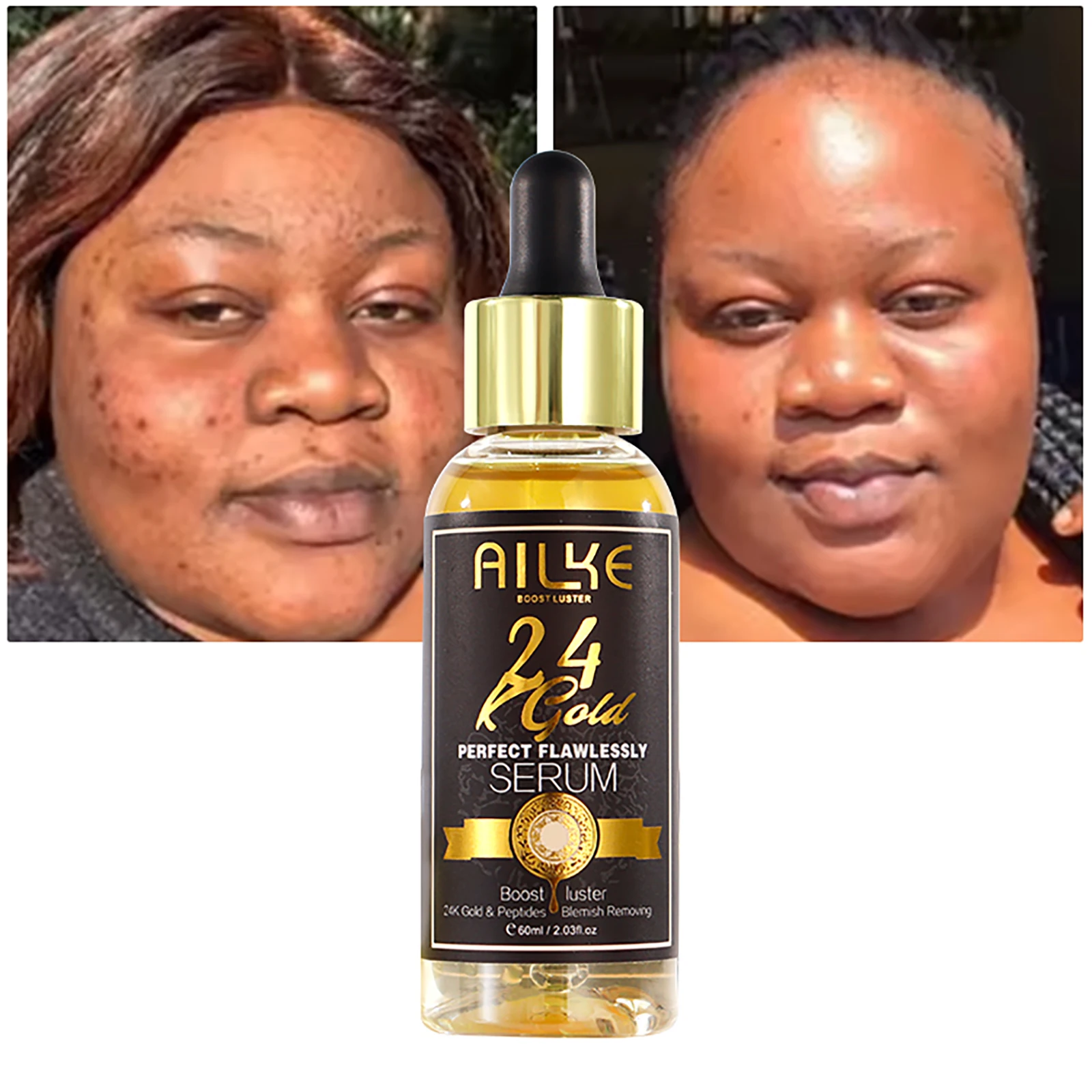AILKE 24K Glod Flawlessly Skin Care Set, Whitening, Reduce Dark Spots, Pigmentation, Wrinkles, Moisturize, For All Skin Types