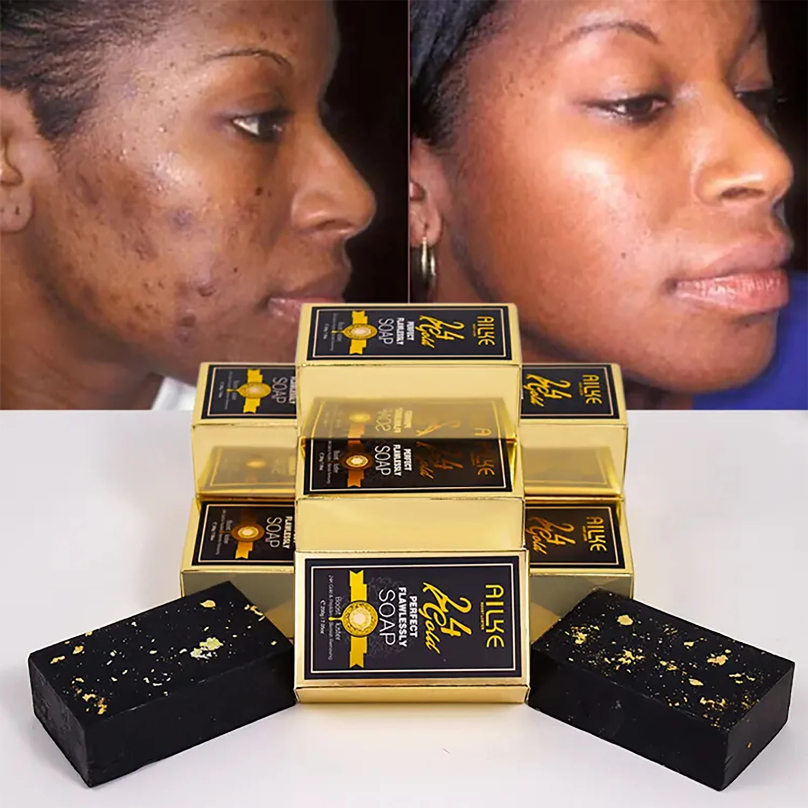 AILKE 24K Glod Flawlessly Skin Care Set, Whitening, Reduce Dark Spots, Pigmentation, Wrinkles, Moisturize, For All Skin Types