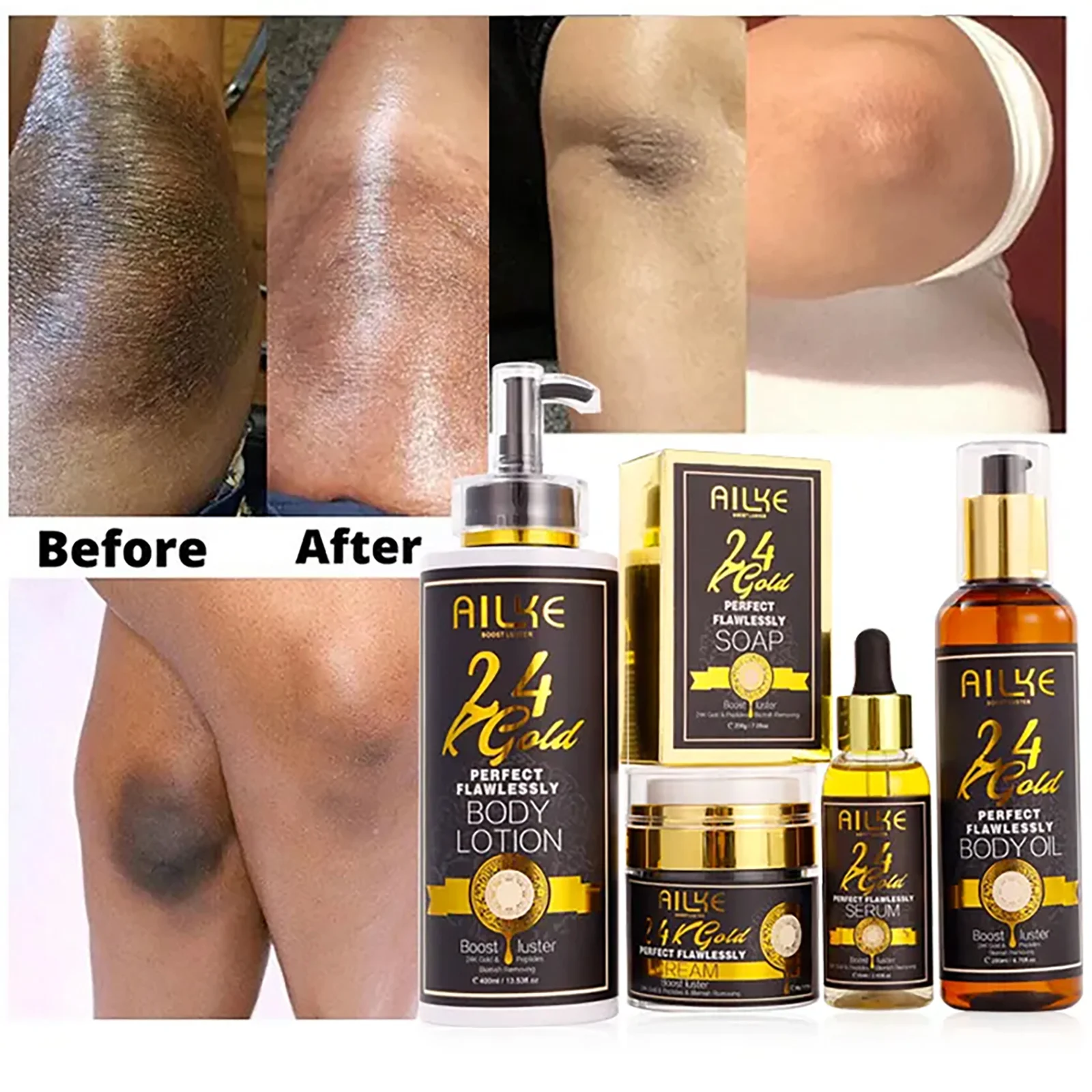 AILKE 24K Glod Flawlessly Skin Care Set, Whitening, Reduce Dark Spots, Pigmentation, Wrinkles, Moisturize, For All Skin Types
