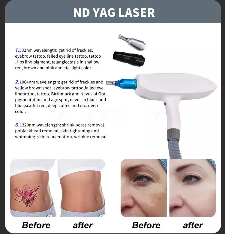 Multifunctional 2 in 1 Professional Beauty Equipment IPL OPT Hair Removal ND Yag Laser Tattoo Removal Pico Second Machine 2023