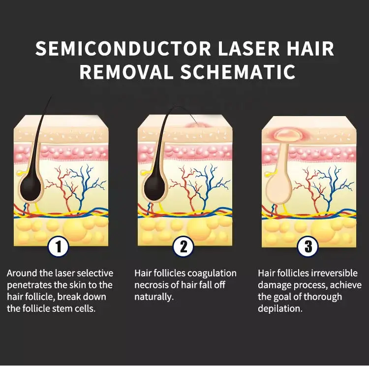 Multifunctional 2 in 1 Professional Beauty Equipment IPL OPT Hair Removal ND Yag Laser Tattoo Removal Pico Second Machine 2023
