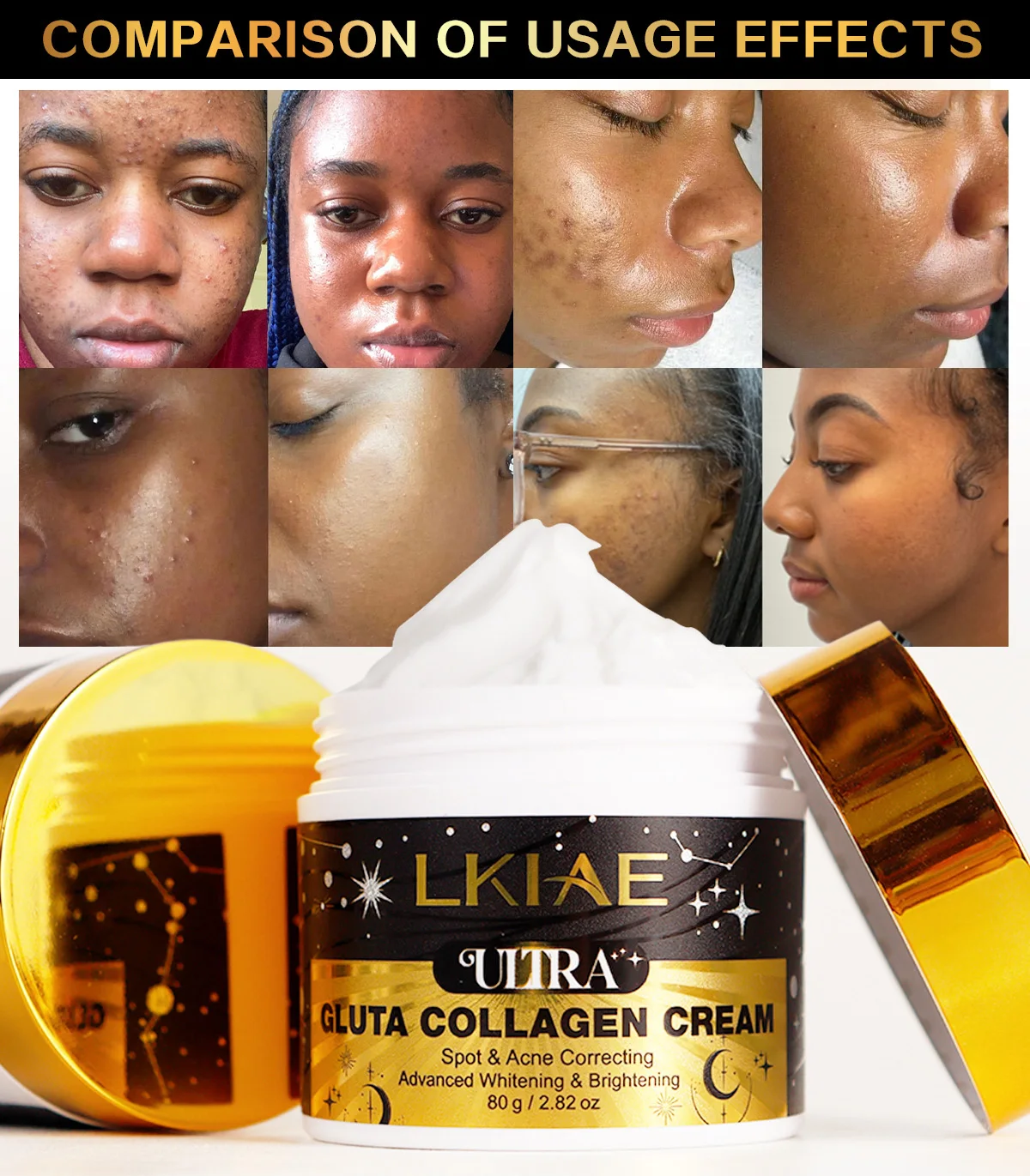 LKIAE Ultra Glutathione Collagen Whitening Face Cream, Acne and Spots Correcting, Even Skin Tone, Reduce Hyperpigmentation, 80g