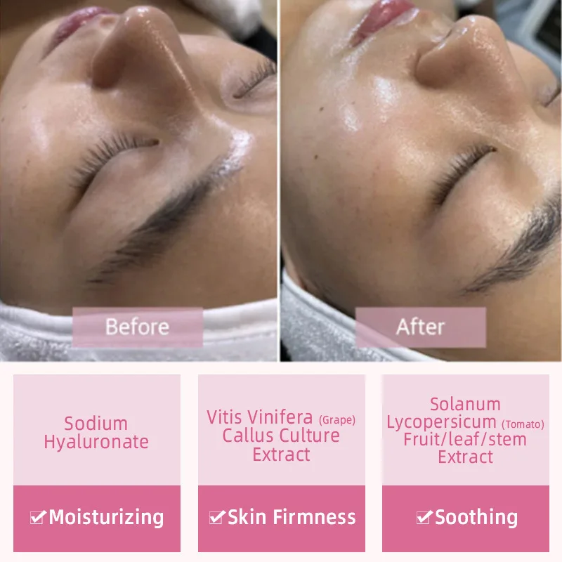 10pcs Salmon DNA PDRN Ampoule Skin Booster Serum Kit Facial Skin Whitening Moisturizing For 0.3mm Microneedle Serum