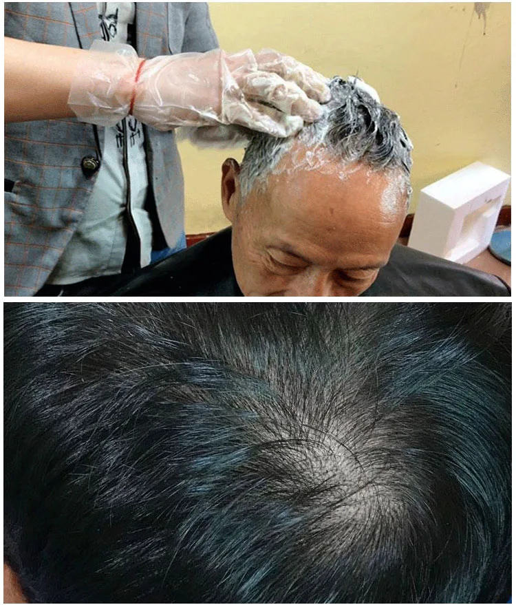 Mokeru 2pc/Lot Noni Fruit Herbal Black Shampoo Magic Fast Mokeru Hair Dye Shampoo For Women Permanent Black Hair Dyeing Shampoo