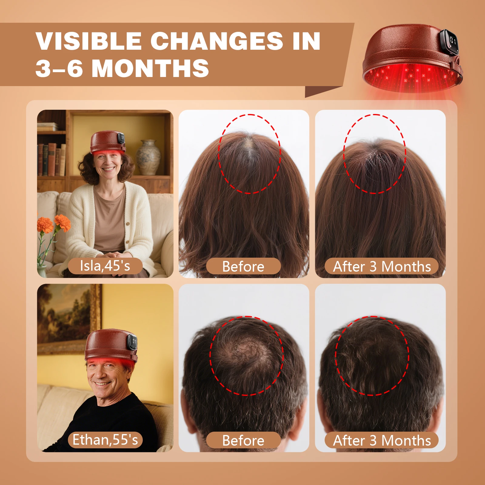 Wireless Hair Growth Laser Cap 120 Diodes 850nm 660nm Anti Hair Loss Stress Relief Infrared Light Relaxation Therapy 4 Levels