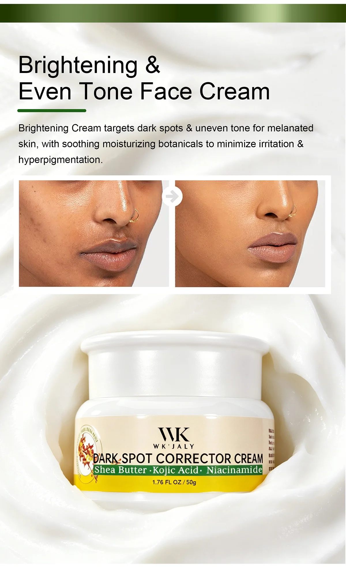 WK JALY Dark Spot Corrector Cream, Whitening Skin, Remove Dark Spots, Melanin, Freckles, With Niacinamide, for All Skin Types