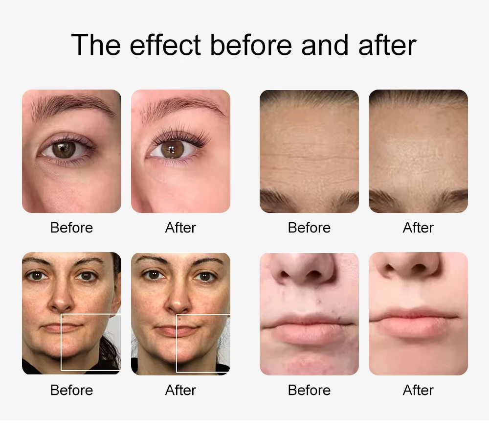 AOKO New 12 IN1 Hydro Dermabrasion Aqua Peeling Ultrasound Facial Care Oxygen Injection Skin Rejuvenation Whiting Beauty Machine