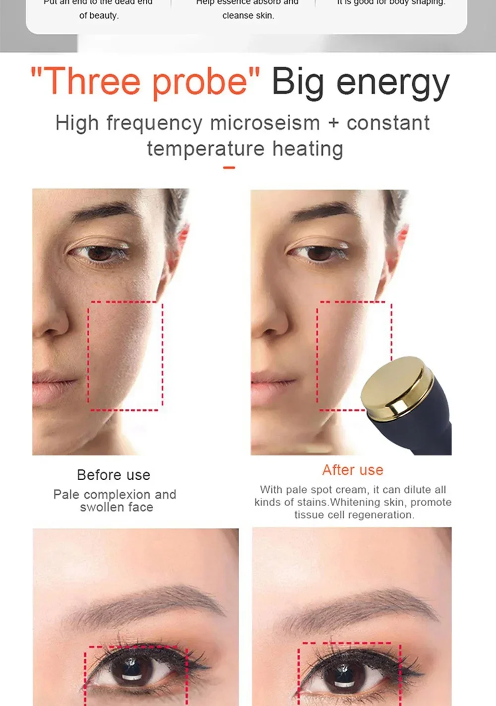 2026 The New Portable Ultrasound Machine 1 MHZ Therapy Skin Care Ltrasonic Facial Machine Anti Aging Face Body Massager