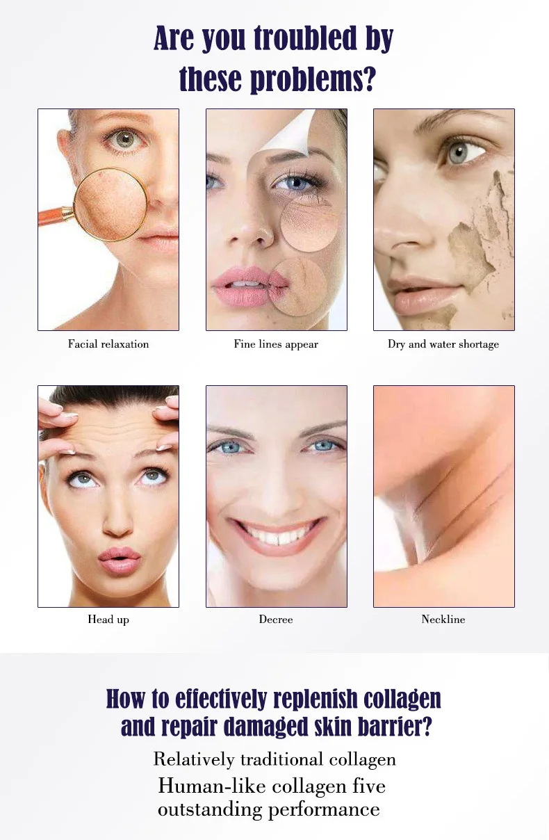 5pcs/lot Anti Wrinkle Korean Cream Collagen Power Lifting Cream 80g Face Cream Skin Care Whitening Moisturizing