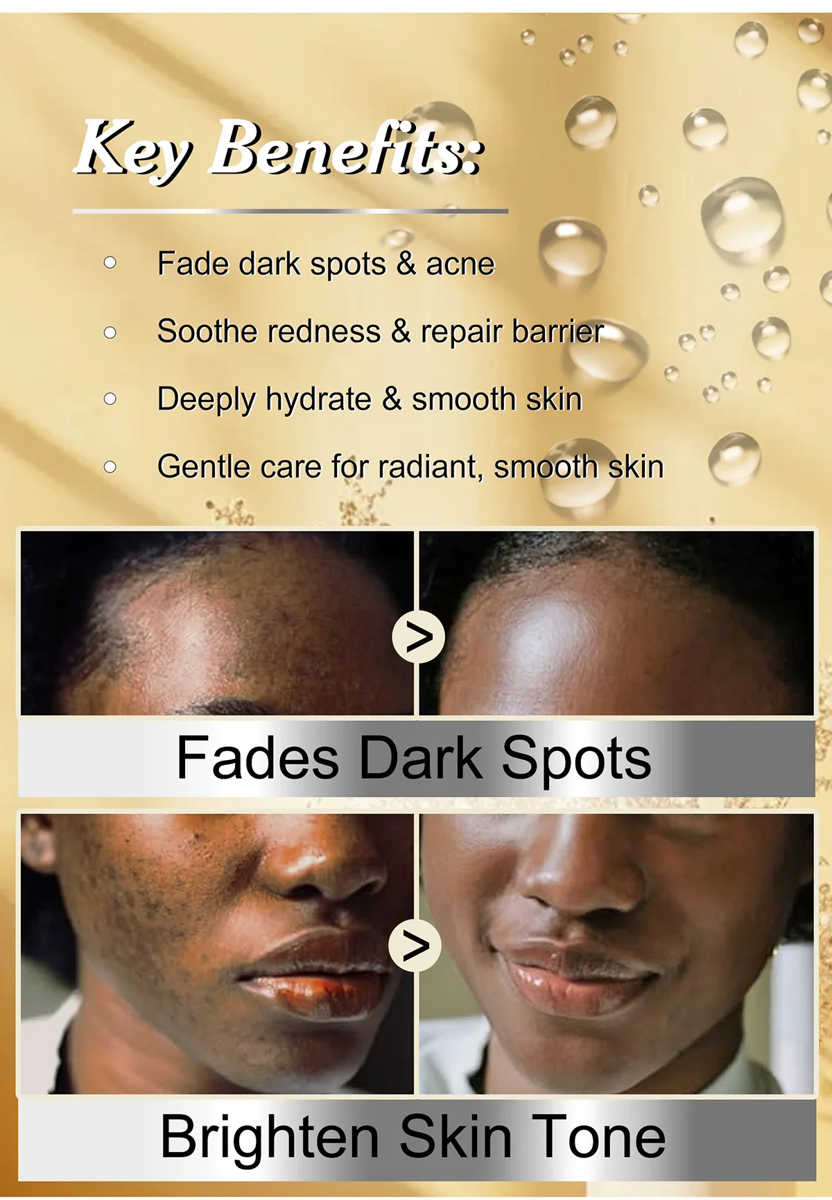 WK JALY Whitening Black Spot Removal Serum, With Niacinamide, Licorice, Remove Melanin, Freckles, Even Skin Tone, for All Skin