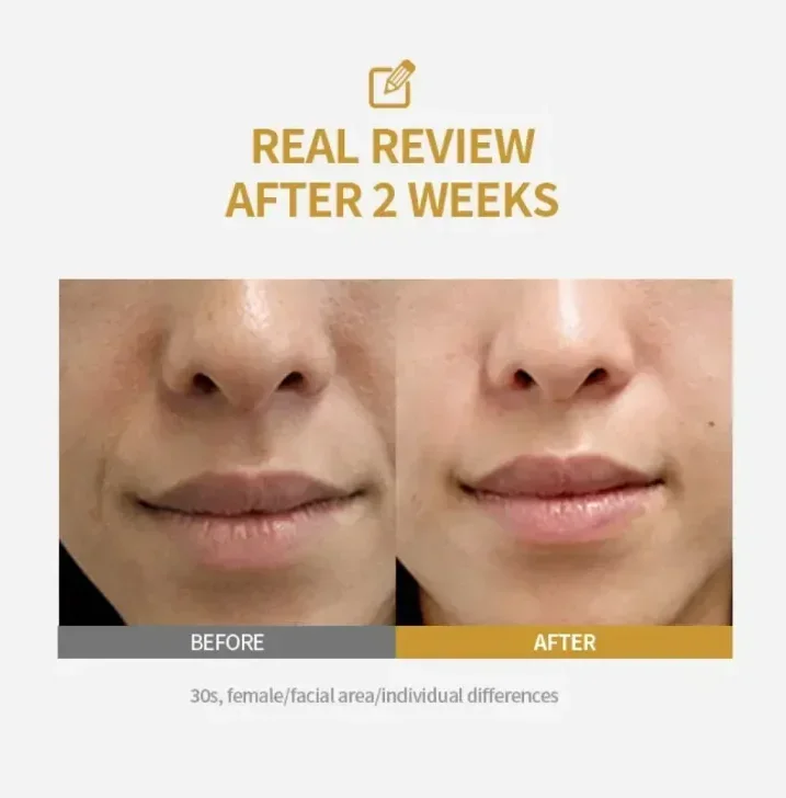KOJIC Acid Niacinamide Ampoule Serum Set Dark Spot care Brightening Firming Hydrating Moisturizing lightening Facial skin care
