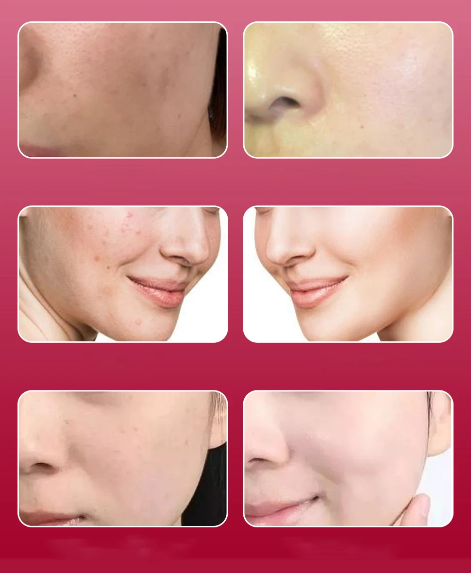 Wholesale Salmon DNA PDRN Face Serum AOxygen Spray Der.pen Kit Jet peeling Beauty Salon Korean Skin Care 5 10 Bottles Seti