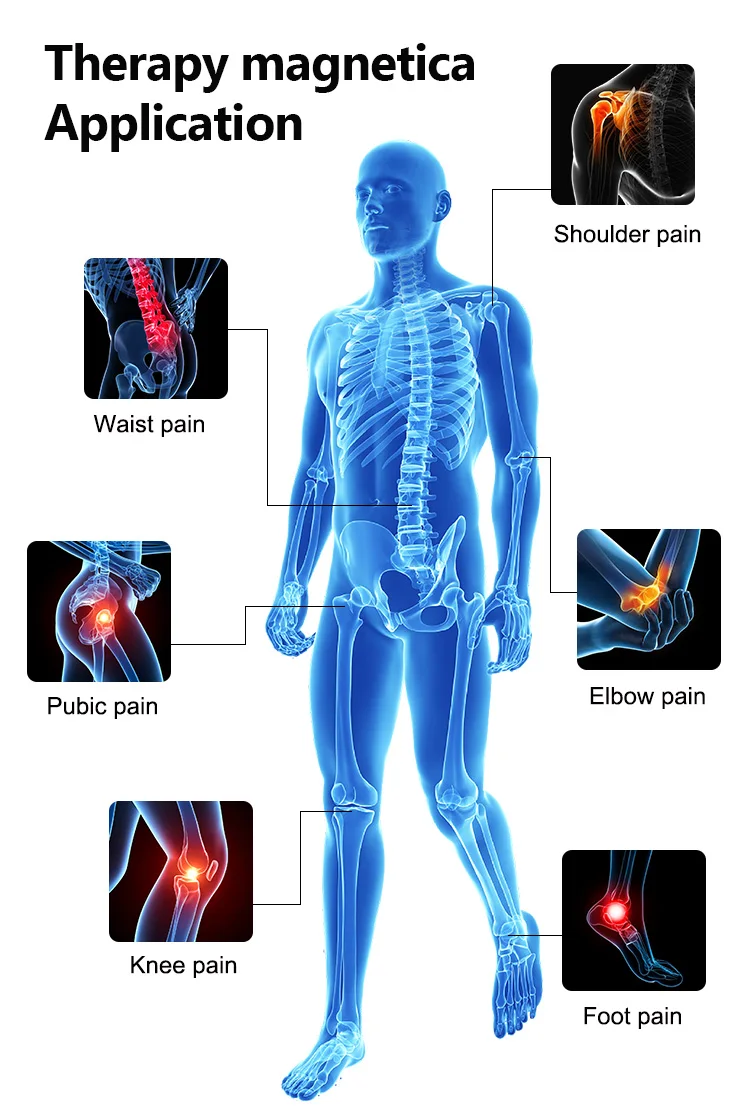 CE Therapy MagneticaElectromagnetic Transduction Rapid pain relief Stimulus strength 4 TeslaTreatment area 9cm*9cm