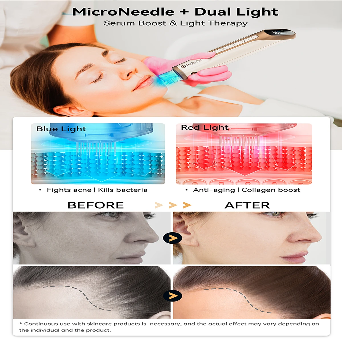 10 pcs Dr Pen H6 Cartridge Needle Cartridge Micro Needle 18Pins 36Pins 42Pins Nano Replacement Microneedling