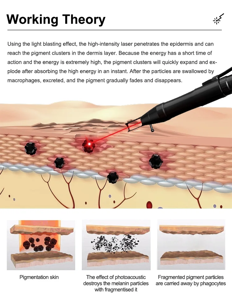 Newest Super Tattoo Removal Picosecond Acne Remove Freckle Removing Painlesslaseroptimal Neatcell Picosecond Lase Pen