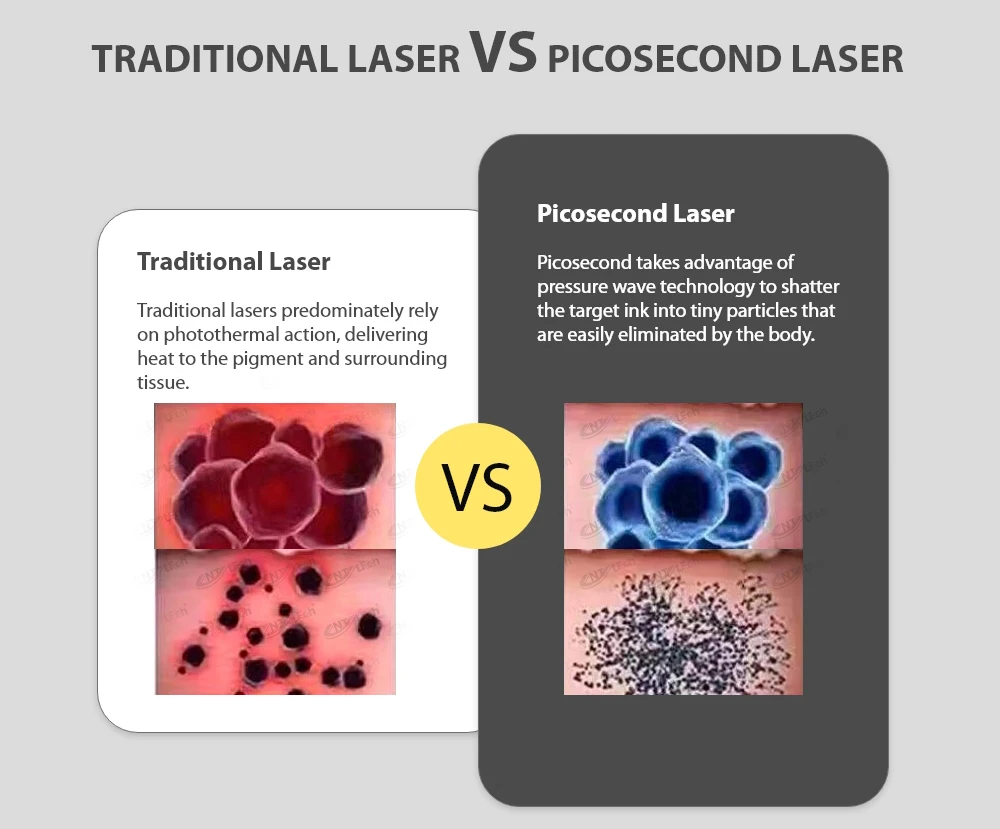 Newest Super Tattoo Removal Picosecond Acne Remove Freckle Removing Painlesslaseroptimal Neatcell Picosecond Lase Pen