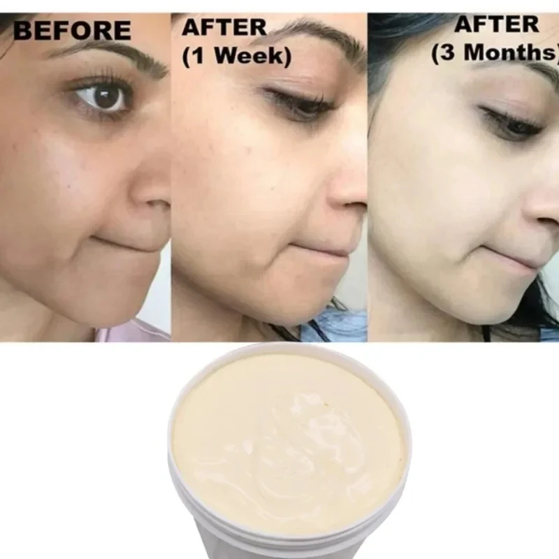 250g Powerful Skin Lightening Cream to Reduce Melanin Face and Whole Body Skin Lightening Cream