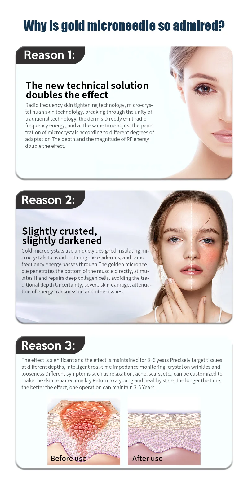Gold Fractional Morpheus 8 Facial Body Rf Microneedling Catridges 64 Pins Inmode Radiofrecuent Morpheus8 Mchine