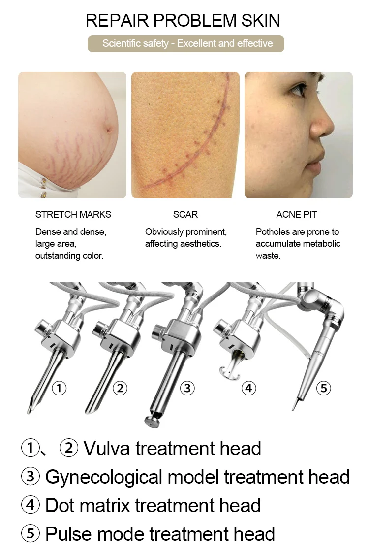 Newest Design 4D Fotona Co2 Fractional Lase Treatment Machine 10600nm Lase Beaut Machine For Resuacing Acne Scars