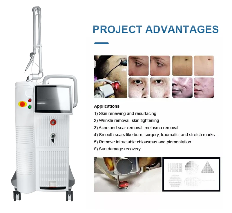 Newest Design 4D Fotona Co2 Fractional Lase Treatment Machine 10600nm Lase Beaut Machine For Resuacing Acne Scars