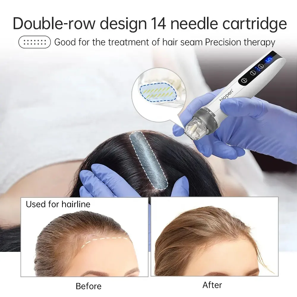 Best Microneedling Pen Bio Pen Q2 EMS Derma Pen With 2 pcs Automatic Serum needles gifts - Led Light Therapy Beauty Equipment