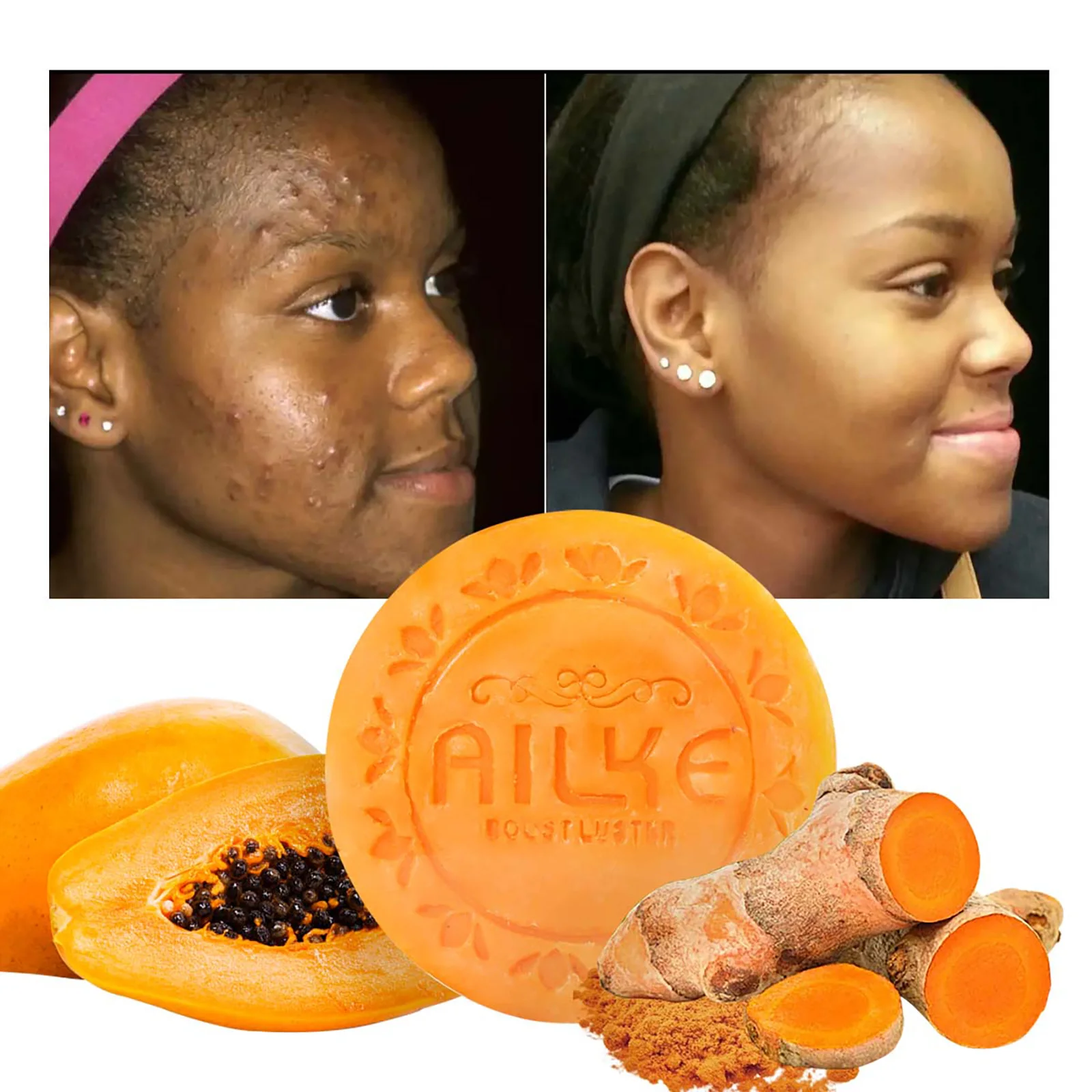 AILKE Lightening Soap Bar for Women, With Natural Turmeric, Papaya, Carrot, Remove Dark Spots, Acne, for All Skin Types, 200g